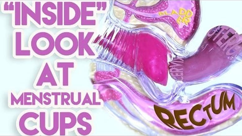 image for An "Inside" Look at Menstrual Cups