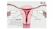 image for Simple Tour of the Menstrual…