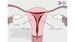 image for Simple Tour of the Menstrual…
