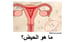 image for