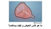 image for 