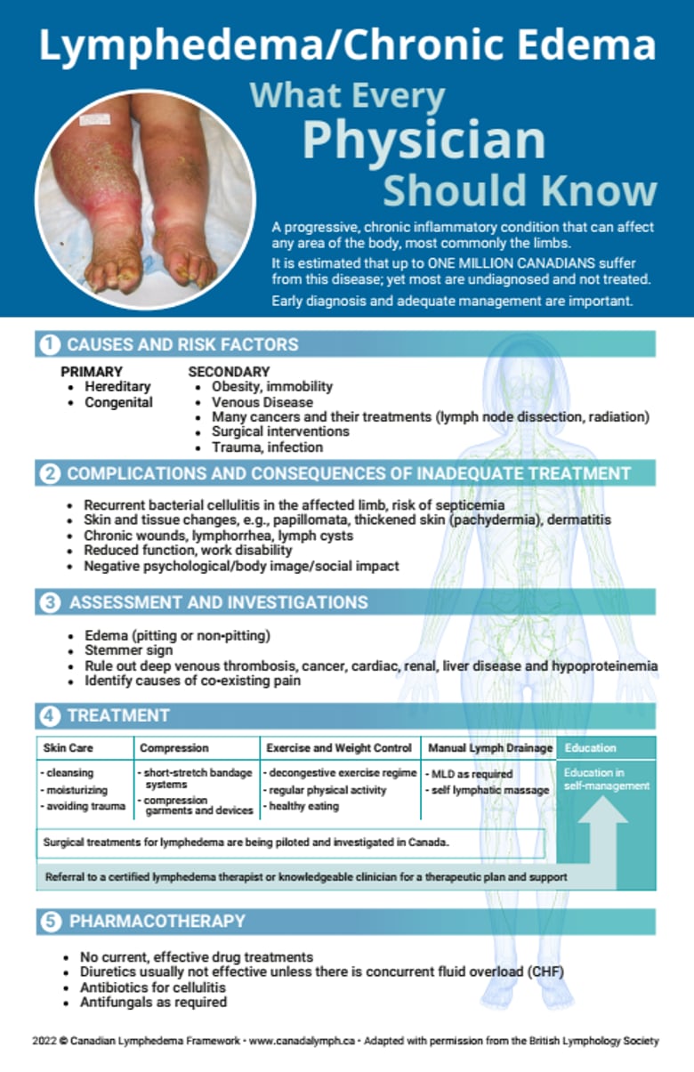 image for Lymphedema/Chronic Edema: What every…